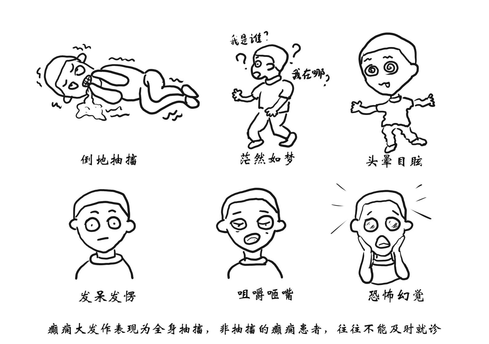 癲癇性精神病